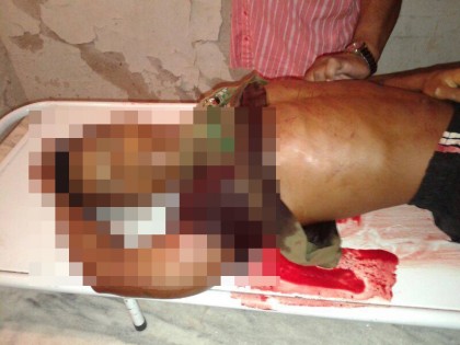 Quarta vítima faleceu no Hospital de Ubatã (Foto: Ubatã Notícias)